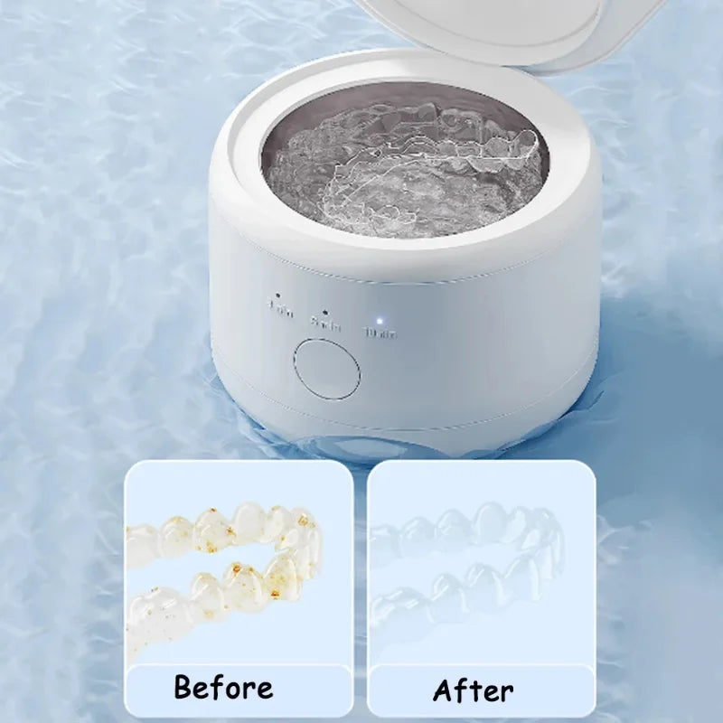 2026 New Electric Braces Box Cleaning Box Multifunction Invisible Retainer Denture Clean Machine Jewelry Orthodontic Cleaner